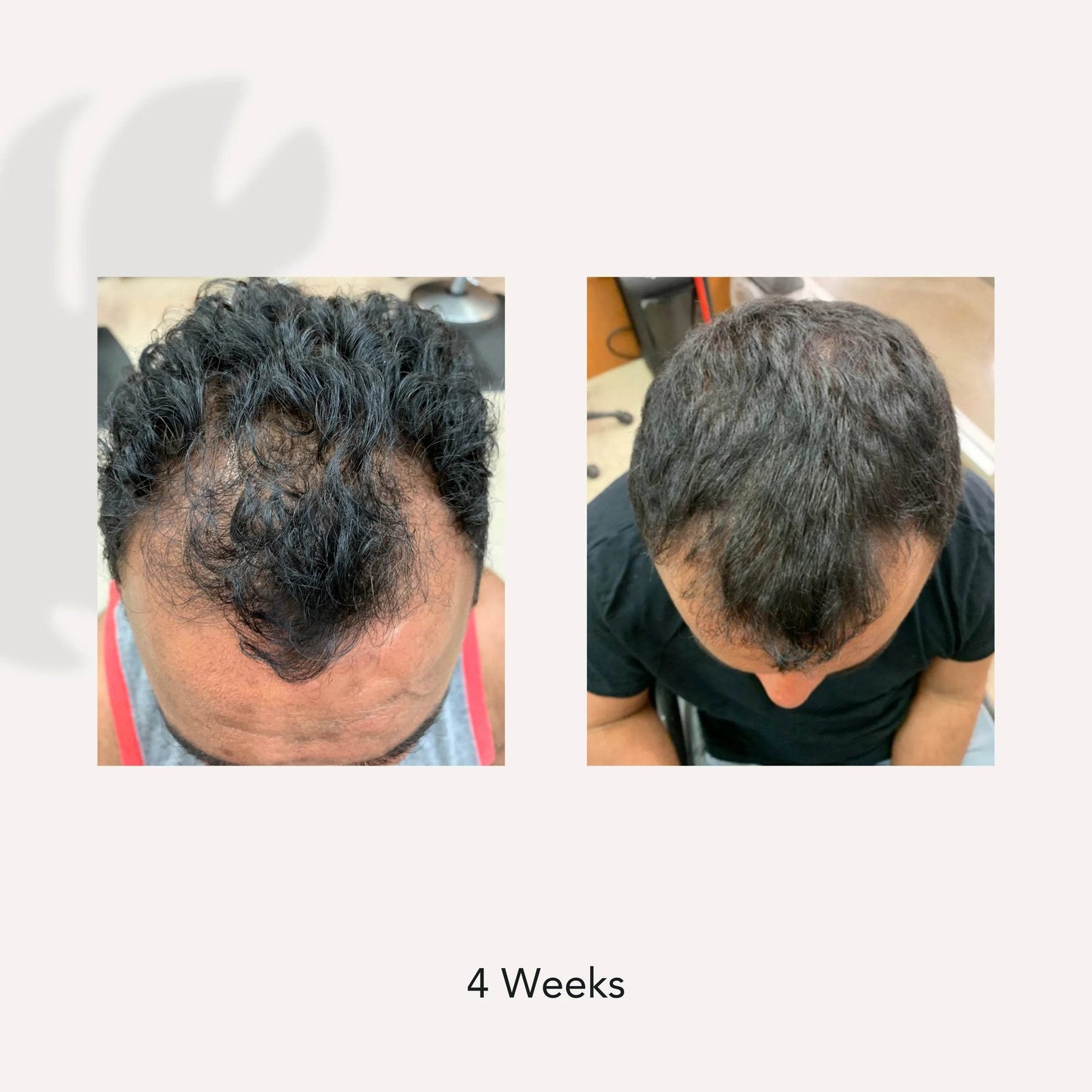 ACTIIV. shampoing traitement perte de cheveux hommes Recover - Oli & Eve | Boutique capillaire végane et sans cruauté