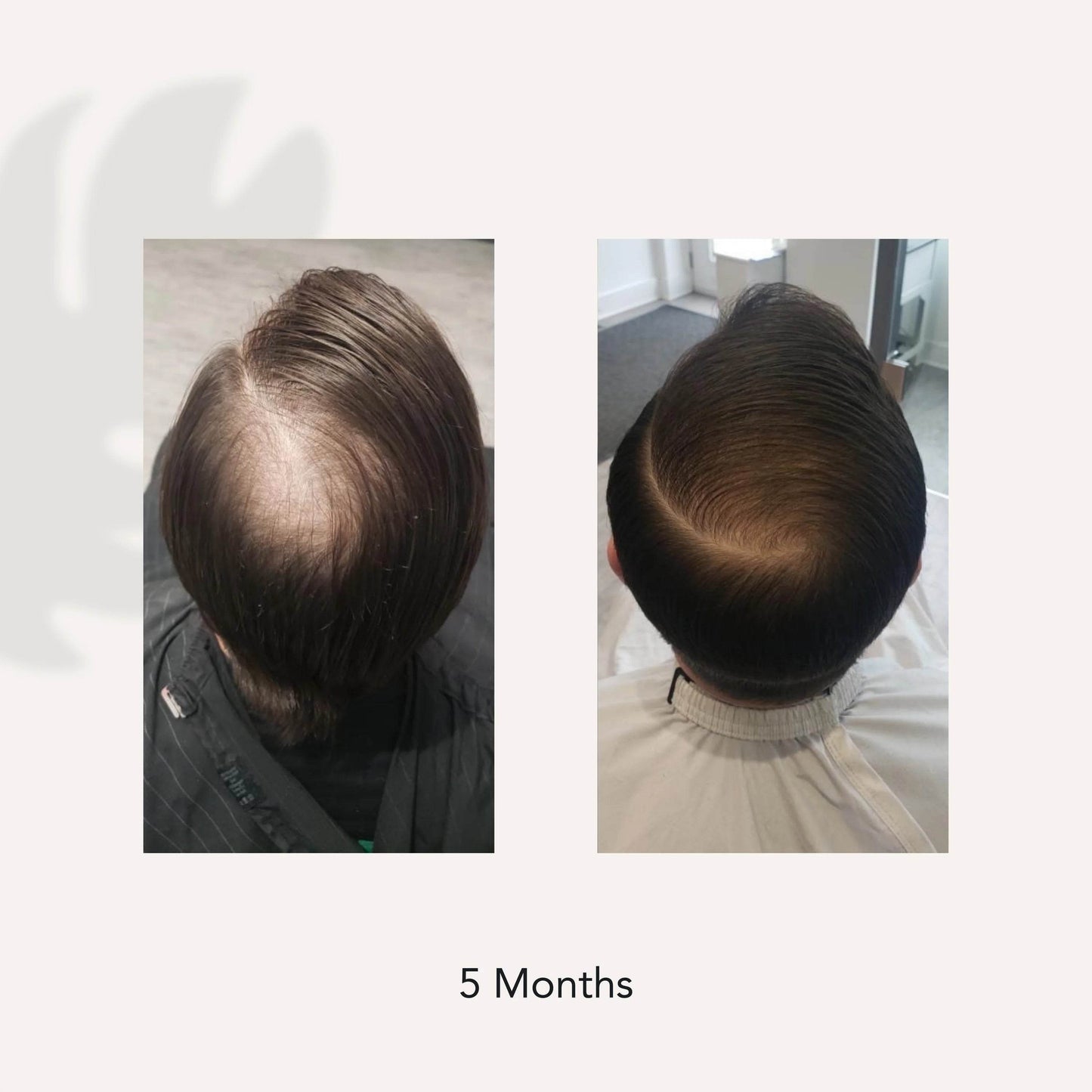 ACTIIV. shampoing traitement perte de cheveux hommes Recover - Oli & Eve | Boutique capillaire végane et sans cruauté